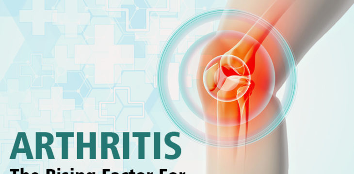 Arthritis The Rising Factor For Knee Replacement Surgery