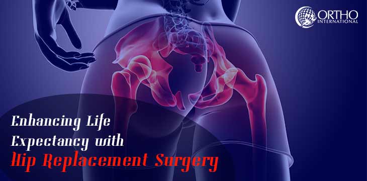 Enhancing Life expectancy with Hip Replacement Surgery