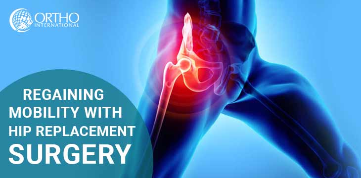 Regaining Mobility with Hip replacement Surgery