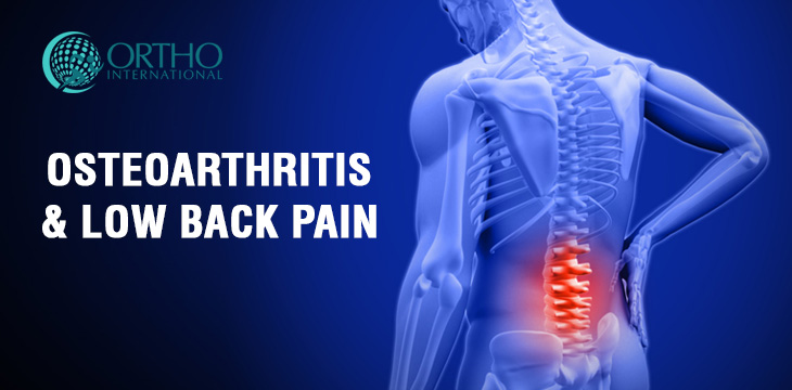 Osteoarthritis & Low Back Pain