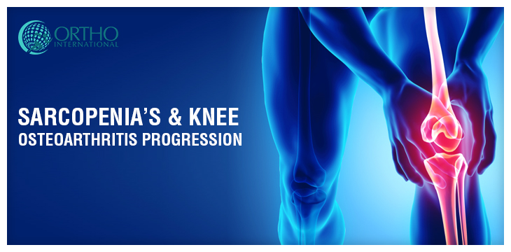 Sarcopenia’s & Knee Osteoarthritis Progression