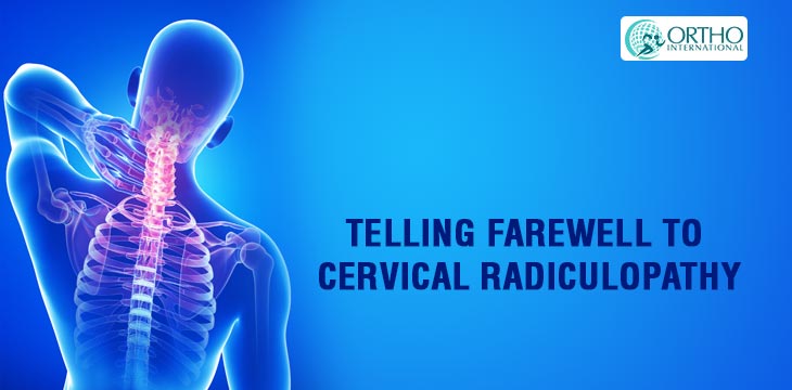 Telling Farewell To Cervical Radiculopathy