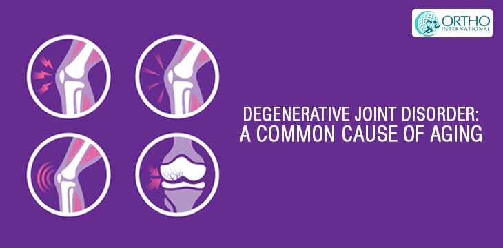 Degenerative Joint Disorder:  A Common Cause Of Aging